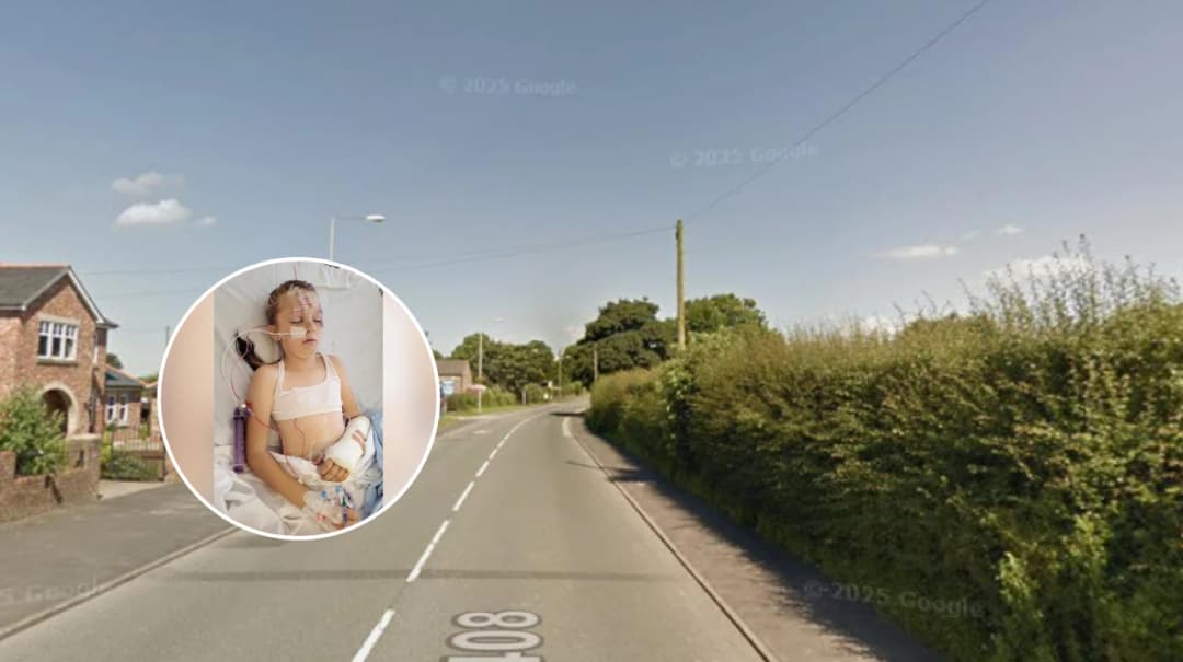 Child Hospitalised in Blackrod Car Collision
