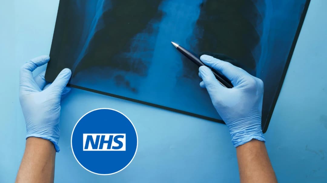 Horwich NHS Free Lung Health Check: Early Lung Cancer Screening 2025